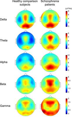 Abnormal Spontaneous Gamma Power Is Associated With Verbal Learning and Memory Dysfunction in Schizophrenia